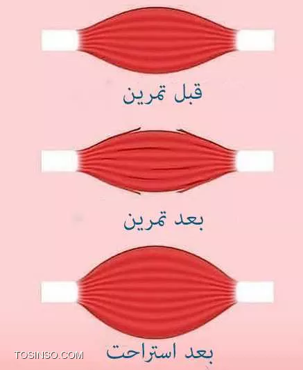 ریکاوری ، امری بسیار مهم ولی نادیده گرفته شده توسط ورزشکاران !